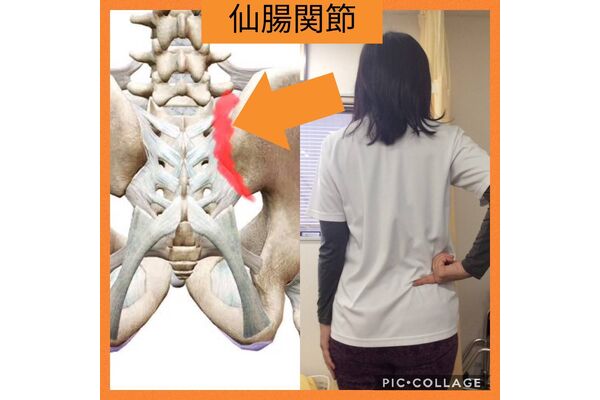 仙腸関節性腰痛の改善にピラティスは有効です 葛飾区のオススメ接骨院 うすざわ接骨院のブログ